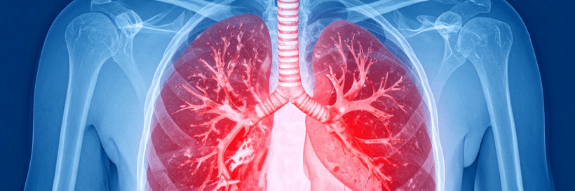 Is Smoking Marijuana Safer Than Smoking Cigarettes 4 insert lung health